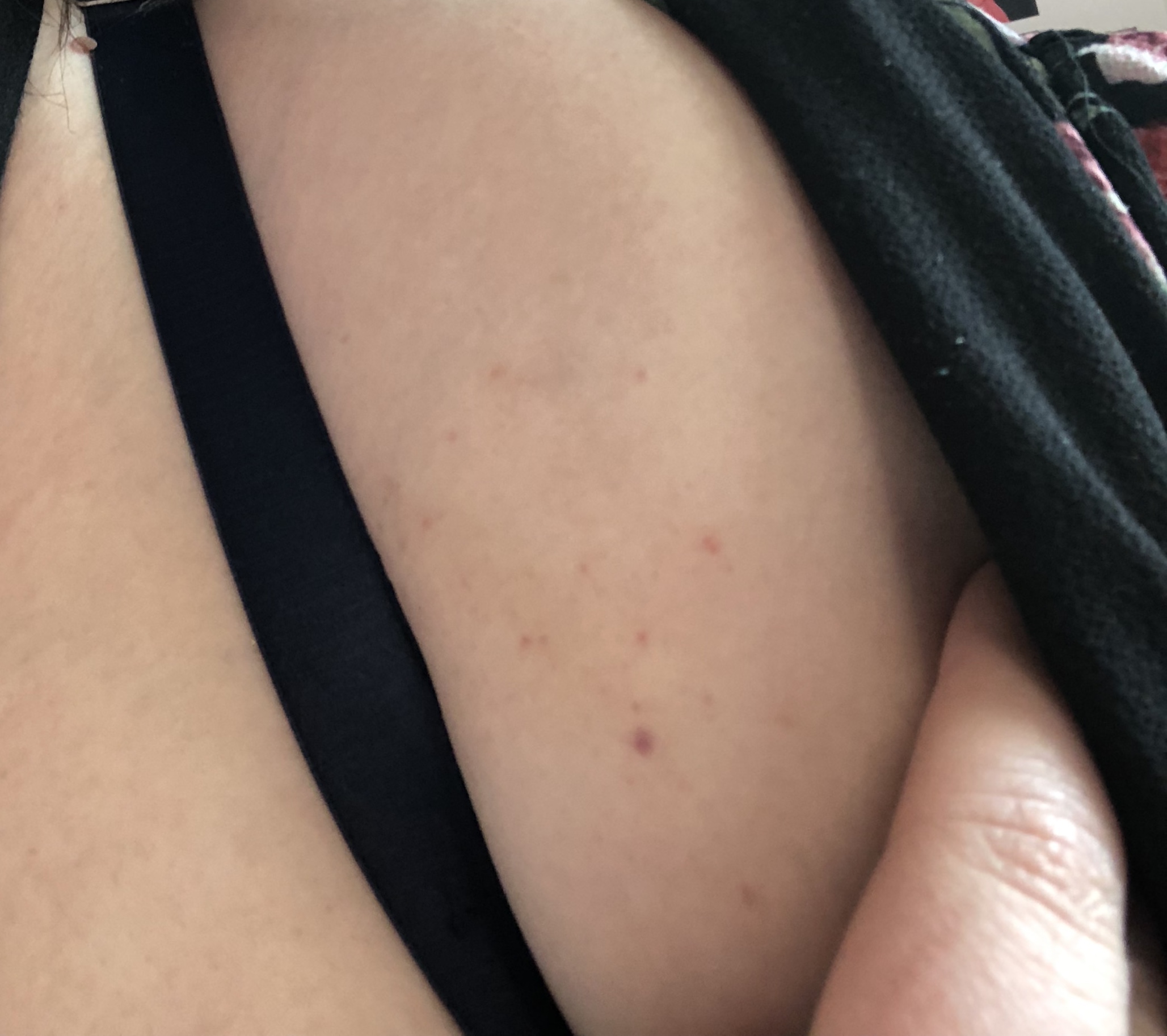 Question About Lymphoma Symptoms Cancer Council Online Community